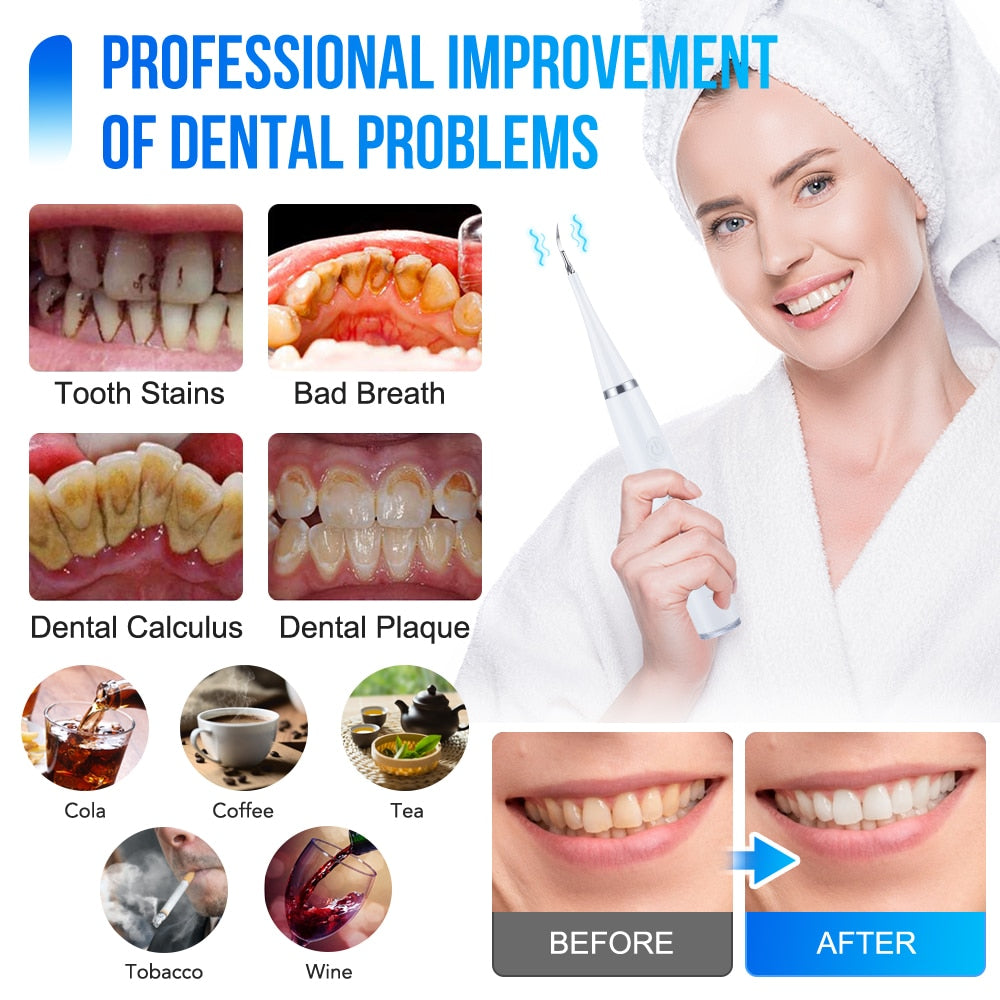 Ms.Dear Irrigator Dental Cleaning Tools Sonic Oral Calculus Removal Teeth Whitening Scaler Tartar Scraper Electric Toothbrush